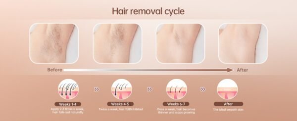 IPL Hair Removal for Women and Men, New Upgraded 999,900 Flashes Permanent Laser - Image 8