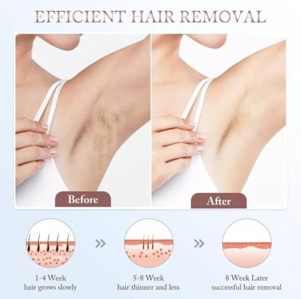 IPL Laser Hair Removal Device for Women and Men, Upgrade At-Home Permanent Painl - Image 6